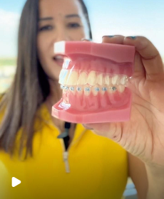 Abrir Instagram Post