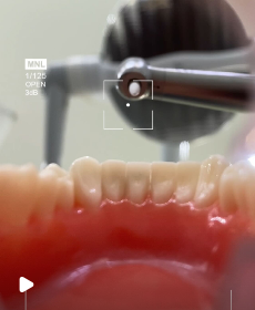 Abrir Instagram Post